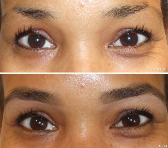 How to Make Your Eyebrows Grow: 5 Proven Methods for Real ...