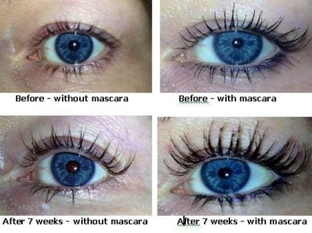 Image result for eyelash growth serum before and after
