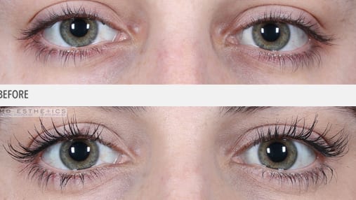 eyelash-growth-serum-before-and-after