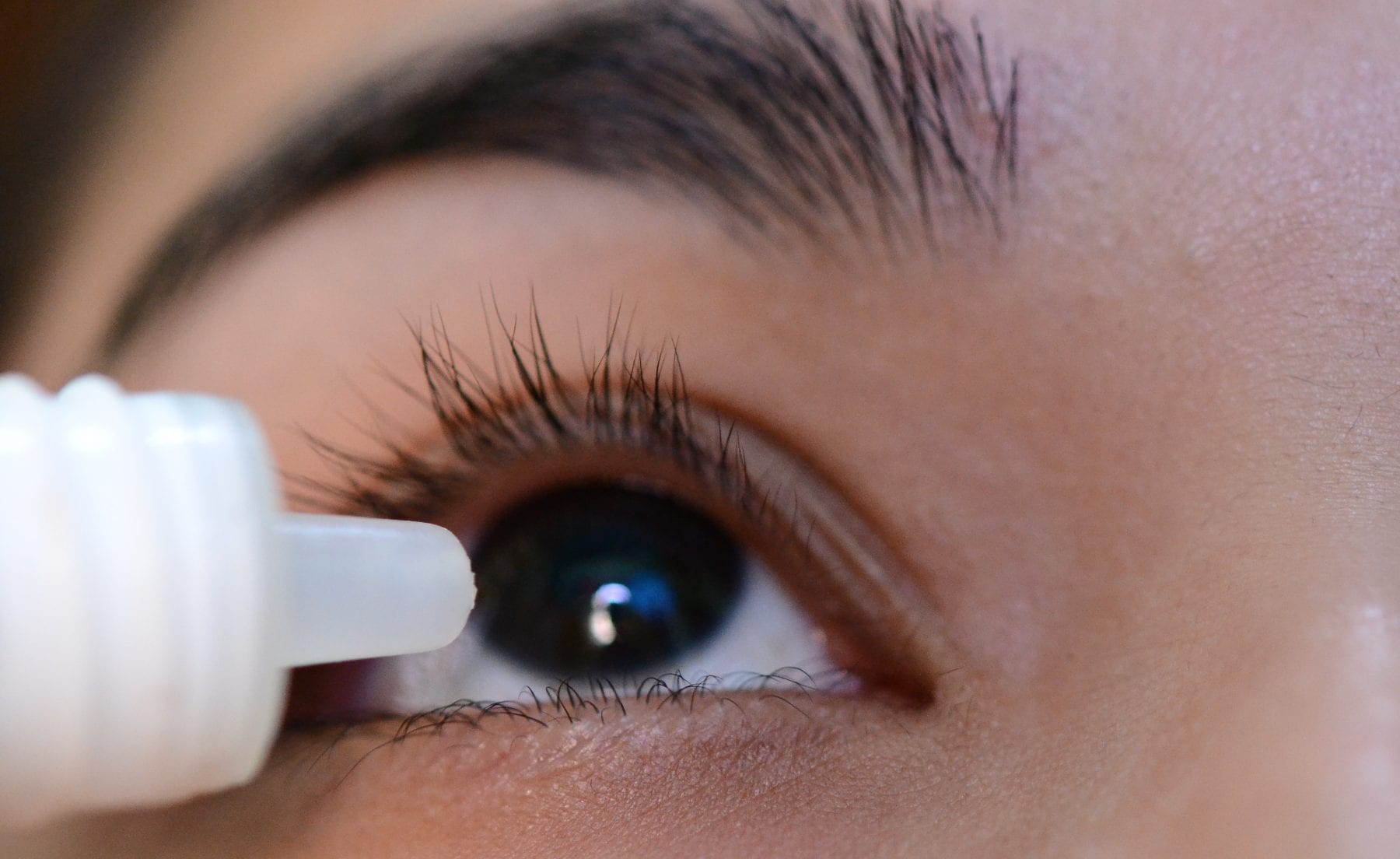 how to get rid of eyelash dandruff