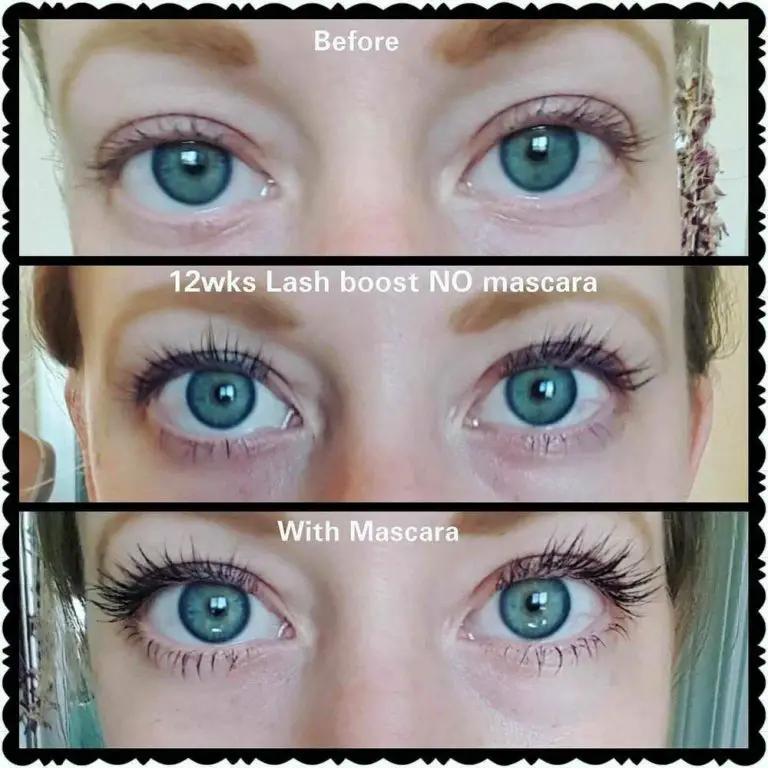 Latisse vs Lash Boost vs RevitaLash Read Before You Buy
