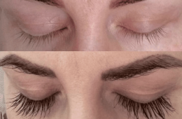 eyelash growth serum that works
